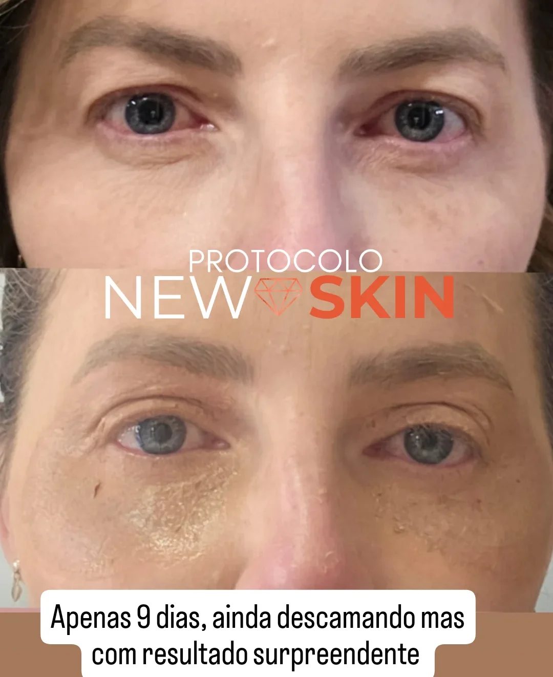 IMG_20250712_093653_118