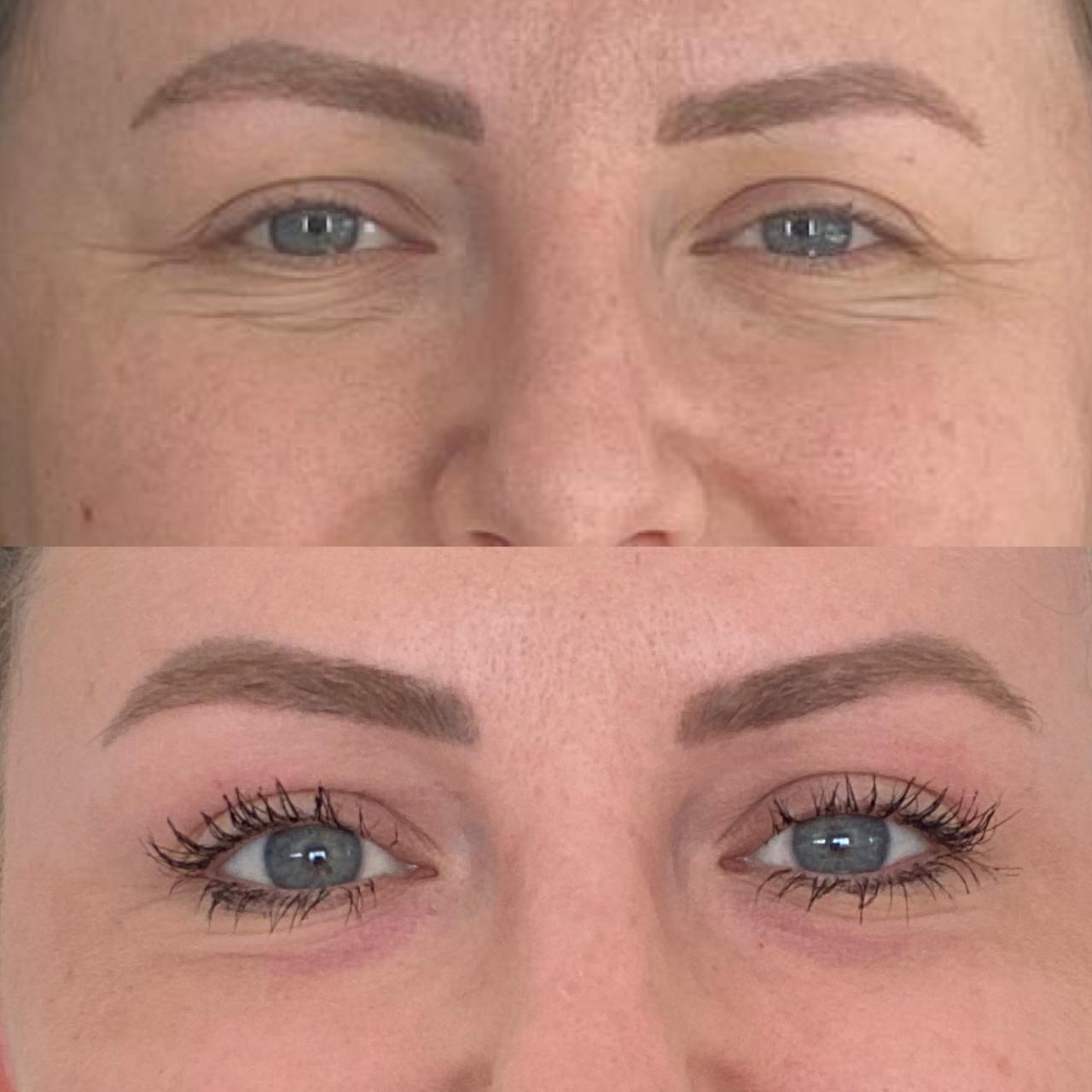 Antes e depois do NewSkin